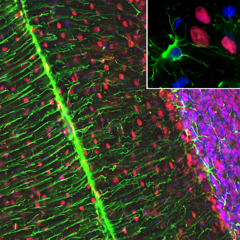 Immunofluorescence - Anti-MeCP2 Antibody - Antibodies.com (A104323)