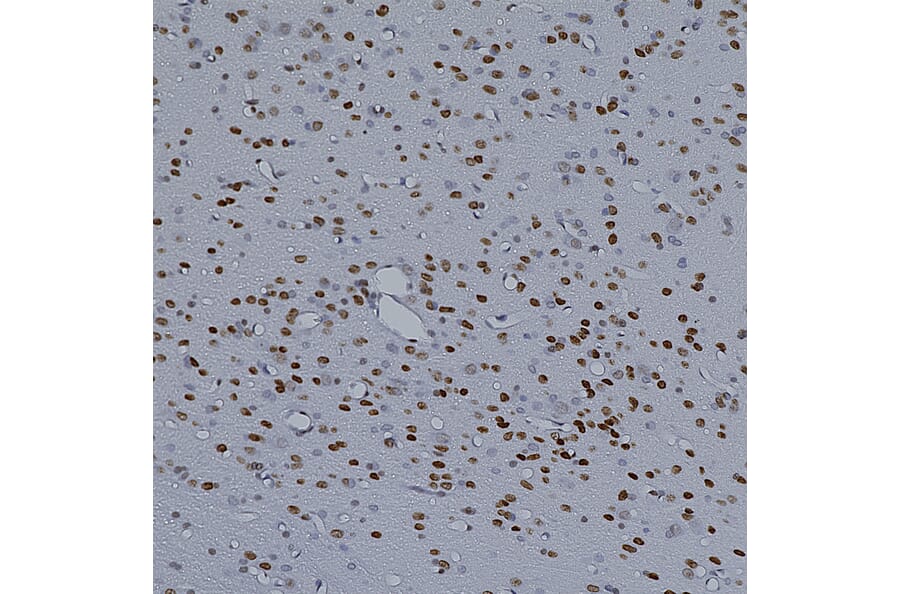 Immunohistochemistry - Anti-MeCP2 Antibody [5H12] (A104323) - Antibodies.com