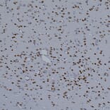 Immunohistochemistry - Anti-MeCP2 Antibody [5H12] (A104323) - Antibodies.com