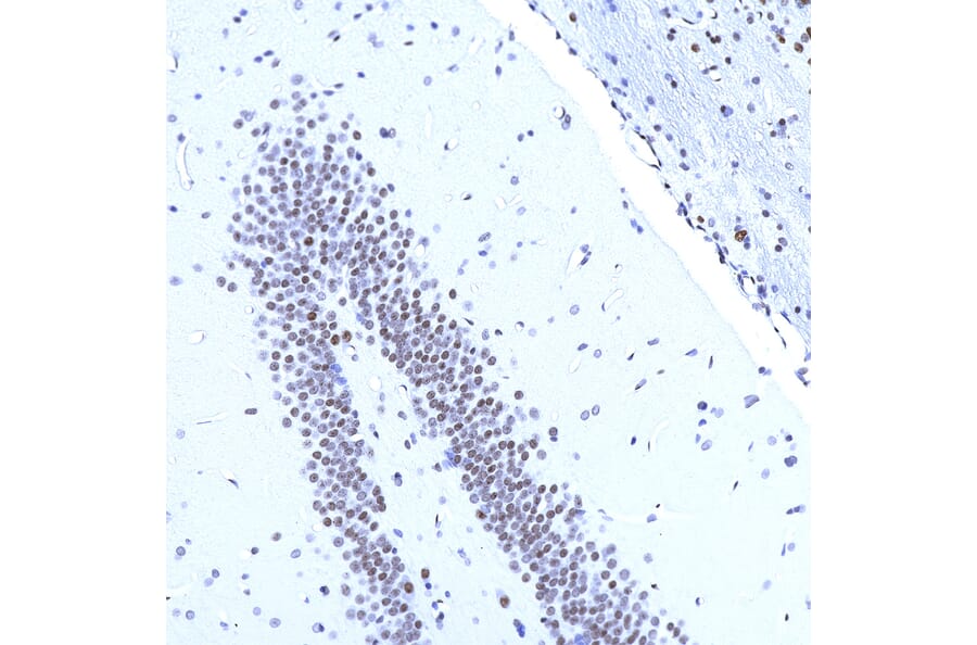 Immunohistochemistry - Anti-MeCP2 Antibody [4F11] (A104324) - Antibodies.com
