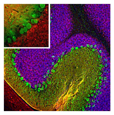 Immunofluorescence - Anti-Calretinin Antibody (A104325) - Antibodies.com