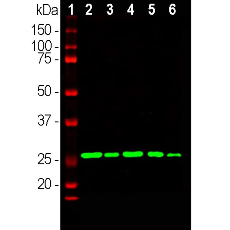 Western Blot - Anti-Calretinin Antibody (A104325) - Antibodies.com