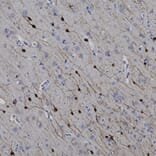 Immunohistochemistry - Anti-Calretinin Antibody (A104325) - Antibodies.com