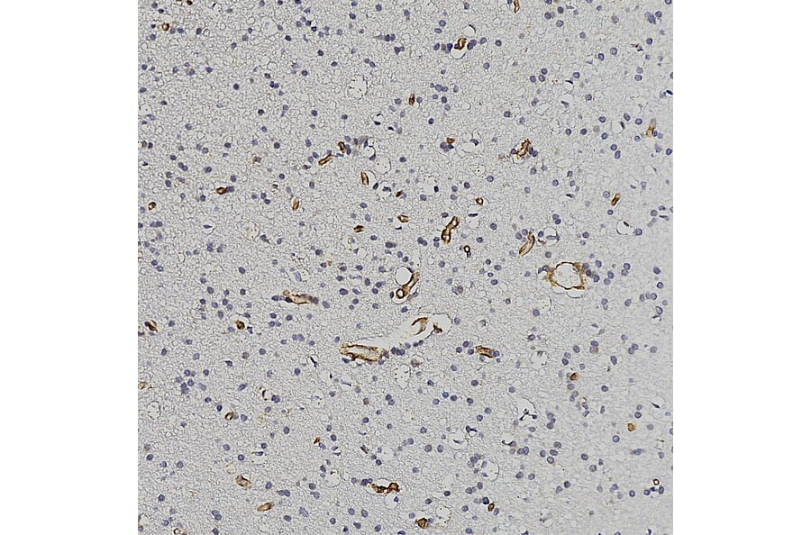 Immunohistochemistry - Anti-Nestin Antibody (A104326) - Antibodies.com