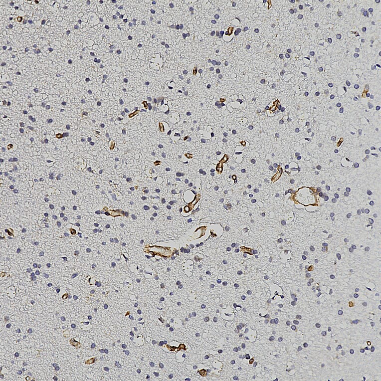 Immunohistochemistry - Anti-Nestin Antibody (A104326) - Antibodies.com