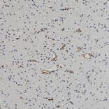 Immunohistochemistry - Anti-Nestin Antibody (A104326) - Antibodies.com