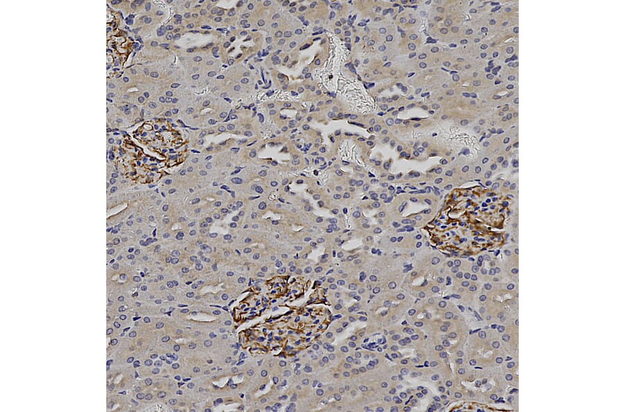 Immunohistochemistry - Anti-Nestin Antibody (A104326) - Antibodies.com