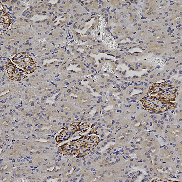 Immunohistochemistry - Anti-Nestin Antibody (A104326) - Antibodies.com