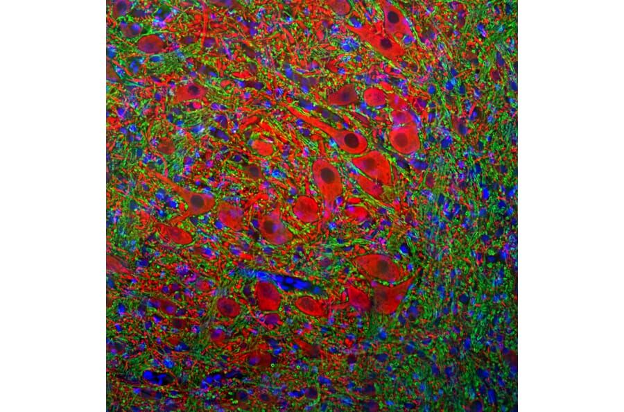 Immunofluorescence - Anti-MAP2A + MAP2B Antibody - Antibodies.com (A104327)
