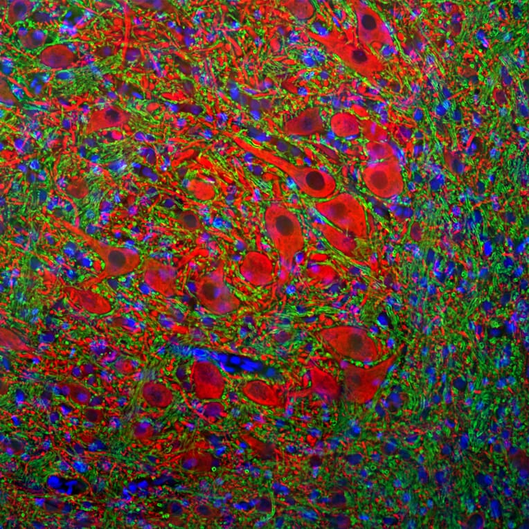 Immunofluorescence - Anti-MAP2A + MAP2B Antibody - Antibodies.com (A104327)