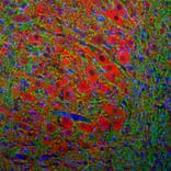 Immunofluorescence - Anti-MAP2A + MAP2B Antibody - Antibodies.com (A104327)
