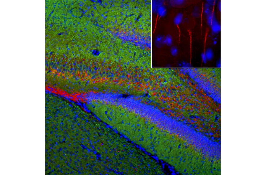 Immunofluorescence - Anti-Ankyrin 3 Antibody (A104331) - Antibodies.com
