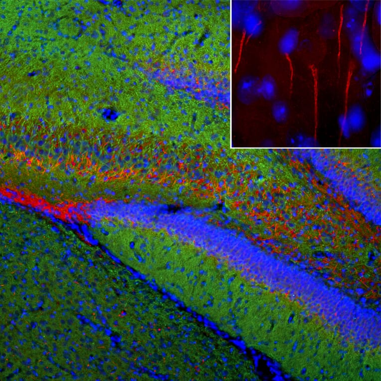 Immunofluorescence - Anti-Ankyrin 3 Antibody (A104331) - Antibodies.com