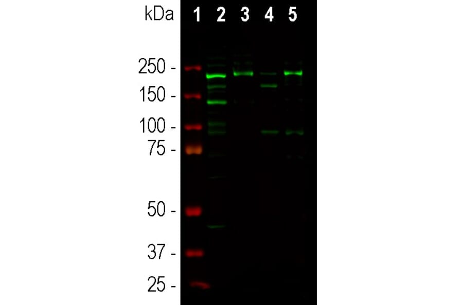 Western Blot - Anti-Ankyrin 3 Antibody (A104331) - Antibodies.com