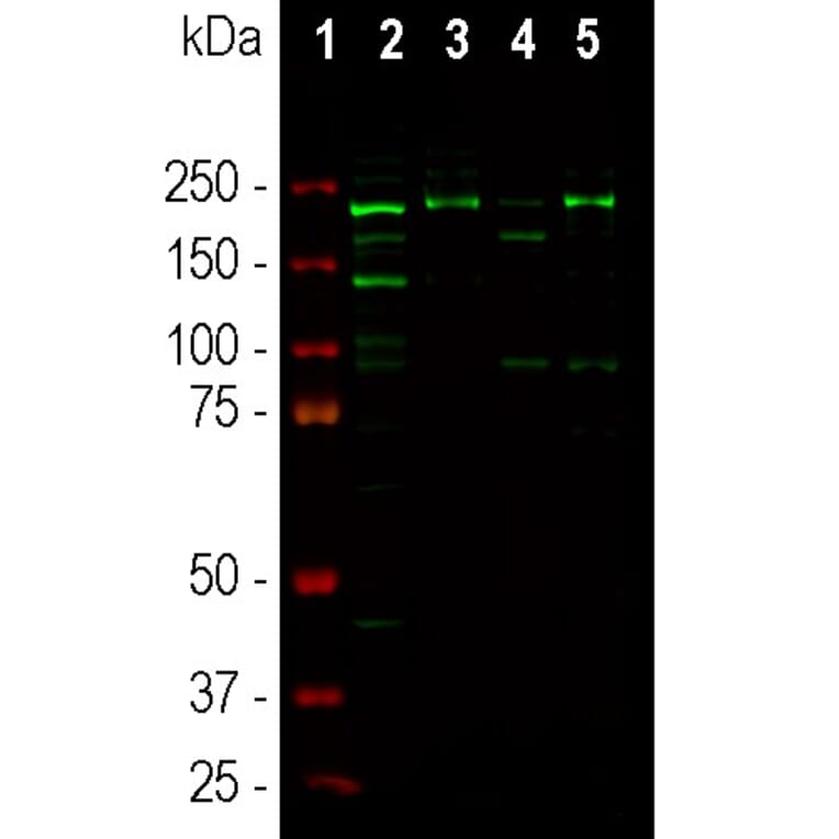 Western Blot - Anti-Ankyrin 3 Antibody (A104331) - Antibodies.com