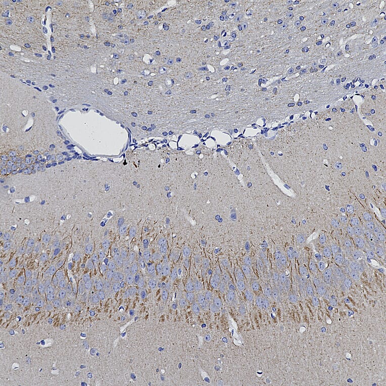 Immunohistochemistry - Anti-Ankyrin 3 Antibody (A104331) - Antibodies.com