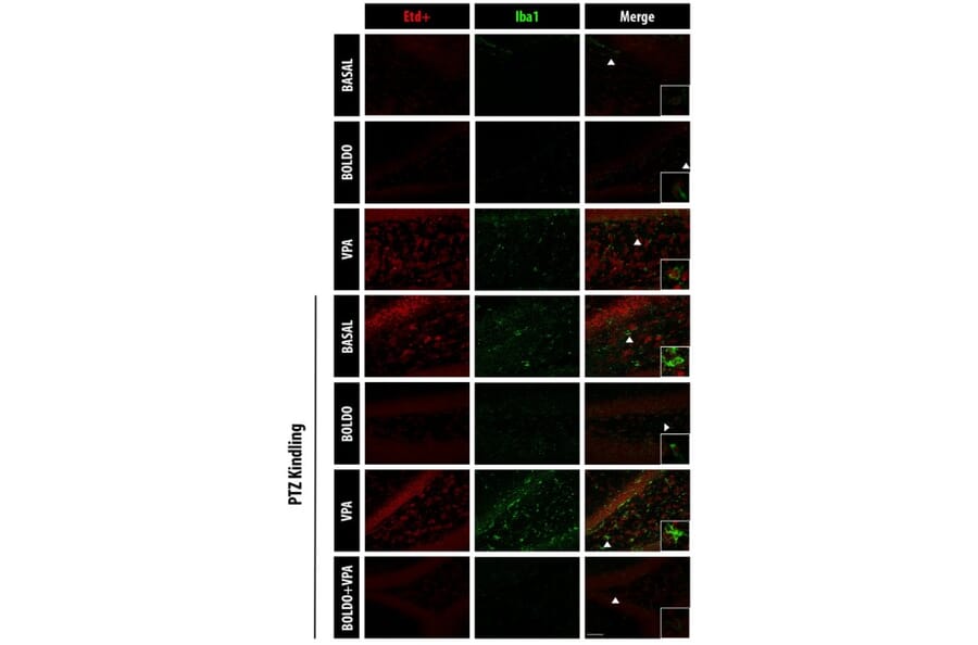 Immunofluorescence - Anti-Iba1 Antibody (A104332) - Antibodies.com