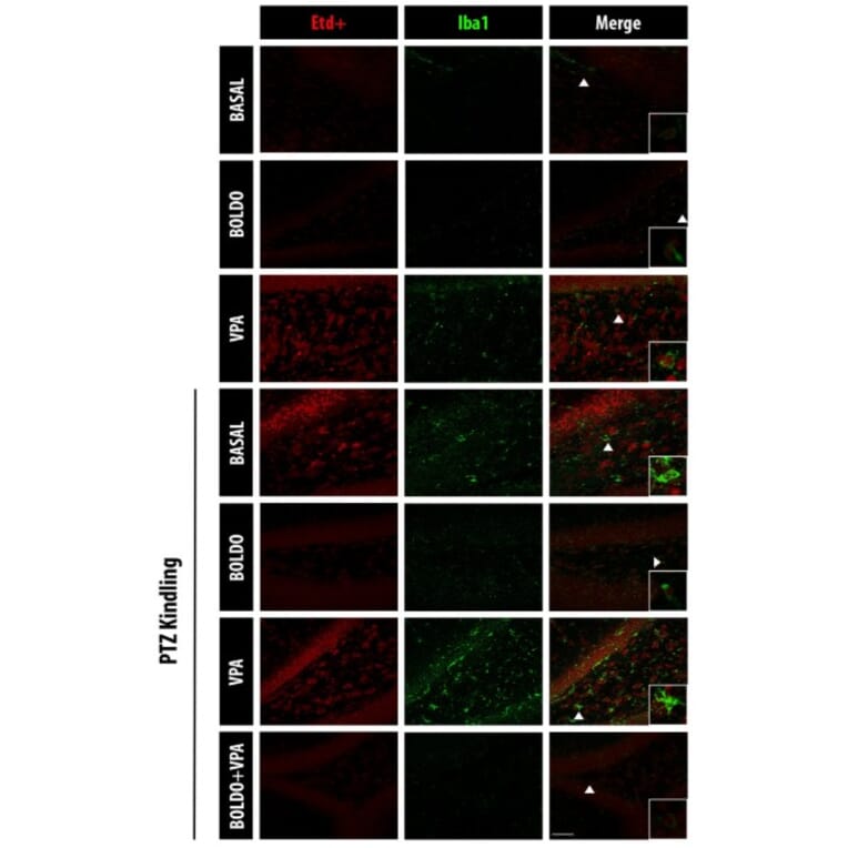 Immunofluorescence - Anti-Iba1 Antibody (A104332) - Antibodies.com
