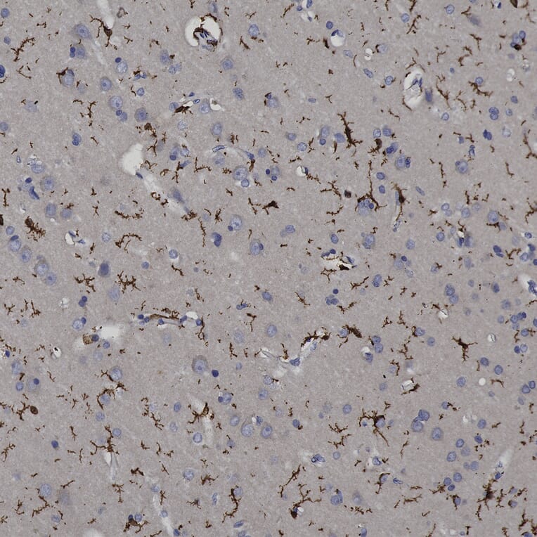 Immunohistochemistry - Anti-Iba1 Antibody (A104332) - Antibodies.com