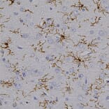 Immunohistochemistry - Anti-Iba1 Antibody (A104332) - Antibodies.com