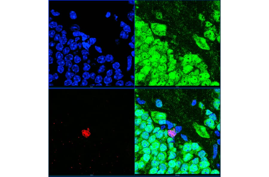 Immunofluorescence - Anti-Ki67 Antibody (A104333) - Antibodies.com
