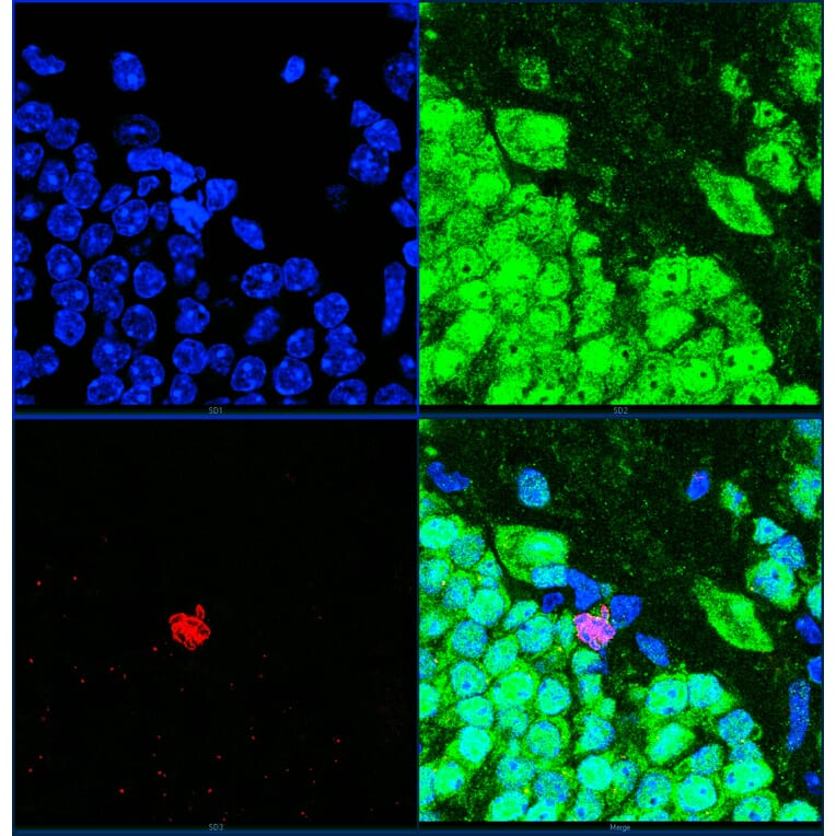 Immunofluorescence - Anti-Ki67 Antibody (A104333) - Antibodies.com
