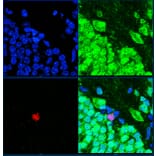 Immunofluorescence - Anti-Ki67 Antibody (A104333) - Antibodies.com