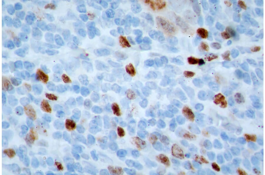 Immunohistochemistry - Anti-Ki67 Antibody (A104333) - Antibodies.com