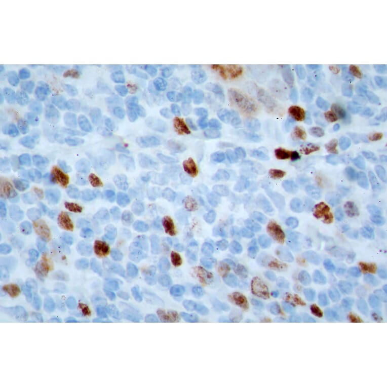 Immunohistochemistry - Anti-Ki67 Antibody (A104333) - Antibodies.com
