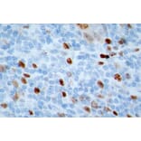 Immunohistochemistry - Anti-Ki67 Antibody (A104333) - Antibodies.com