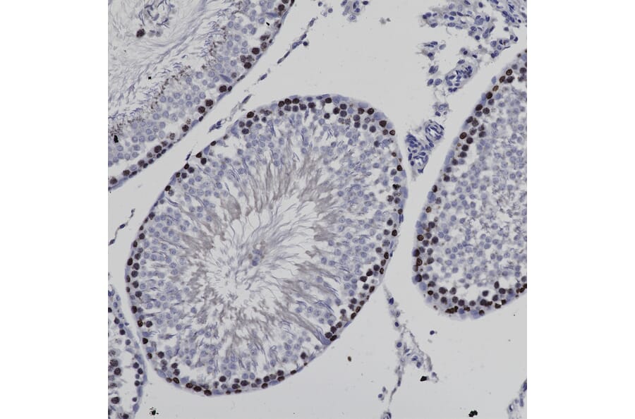 Immunohistochemistry - Anti-Ki67 Antibody (A104333) - Antibodies.com