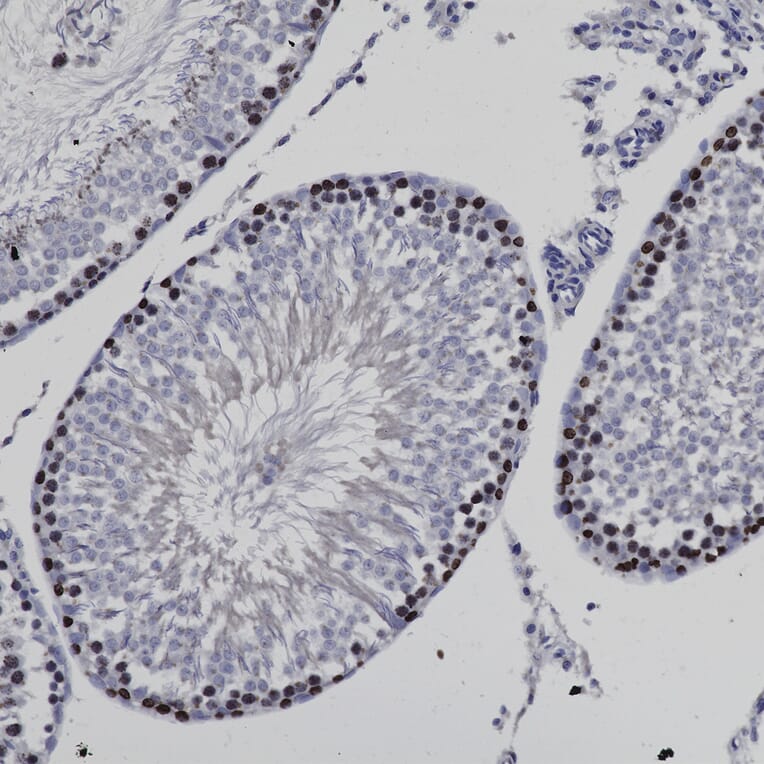 Immunohistochemistry - Anti-Ki67 Antibody (A104333) - Antibodies.com
