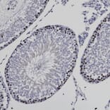Immunohistochemistry - Anti-Ki67 Antibody (A104333) - Antibodies.com