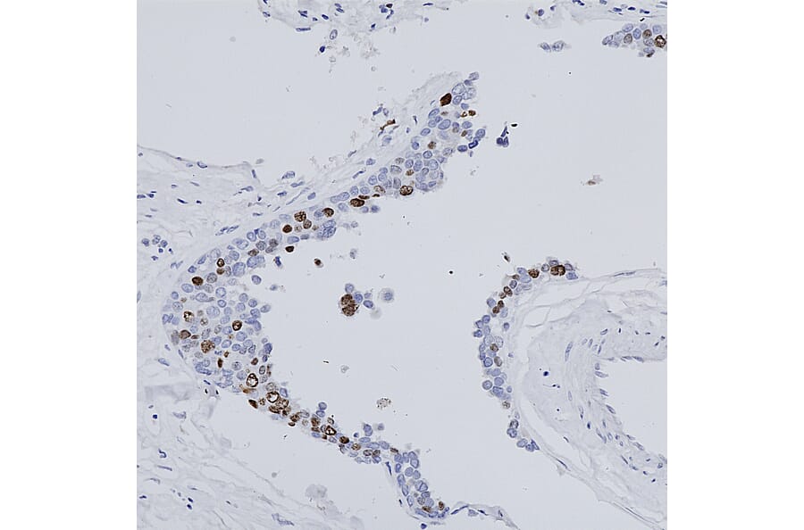 Immunohistochemistry - Anti-Ki67 Antibody (A104333) - Antibodies.com