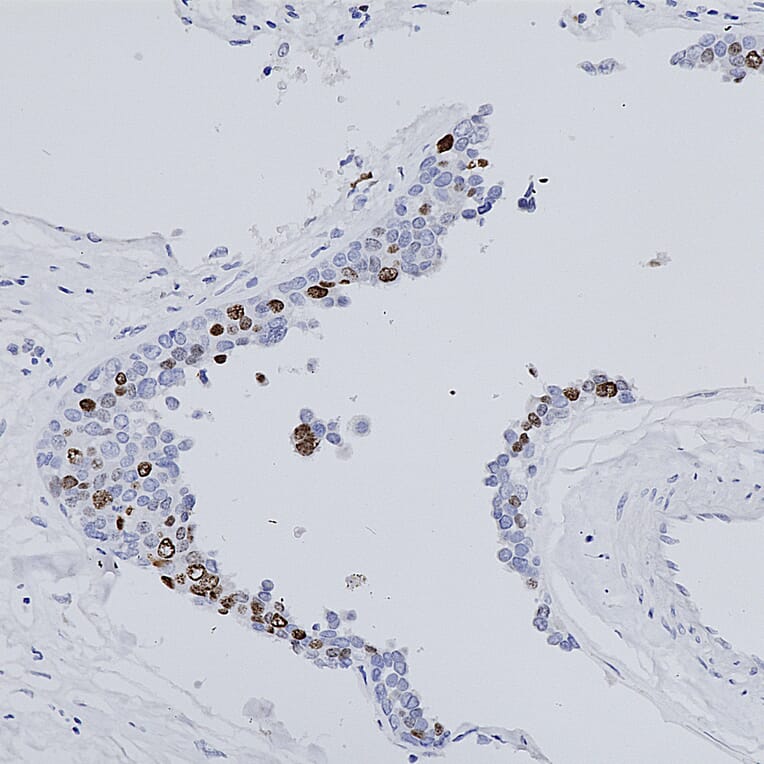 Immunohistochemistry - Anti-Ki67 Antibody (A104333) - Antibodies.com