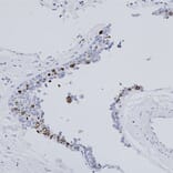 Immunohistochemistry - Anti-Ki67 Antibody (A104333) - Antibodies.com