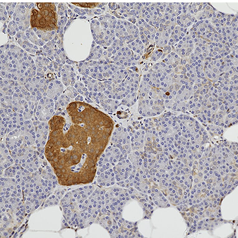 Immunohistochemistry - Anti-NSE Antibody (A104334) - Antibodies.com