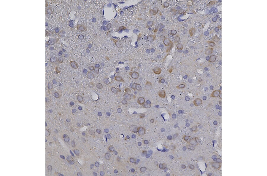 Immunohistochemistry - Anti-NSE Antibody (A104334) - Antibodies.com