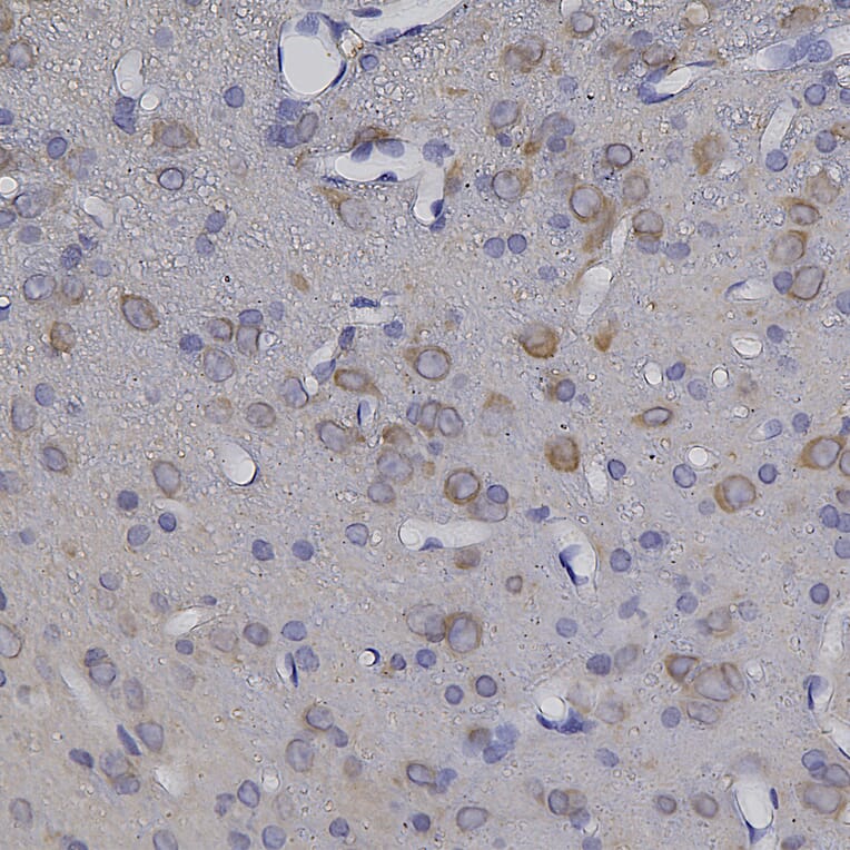 Immunohistochemistry - Anti-NSE Antibody (A104334) - Antibodies.com