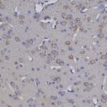Immunohistochemistry - Anti-NSE Antibody (A104334) - Antibodies.com