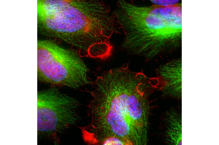 Western Blot - Anti-MARCKS Antibody - Antibodies.com (A104335)