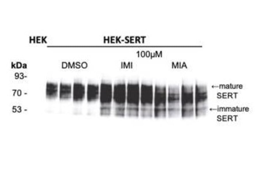 Western Blot - Anti-SERT Antibody - Antibodies.com