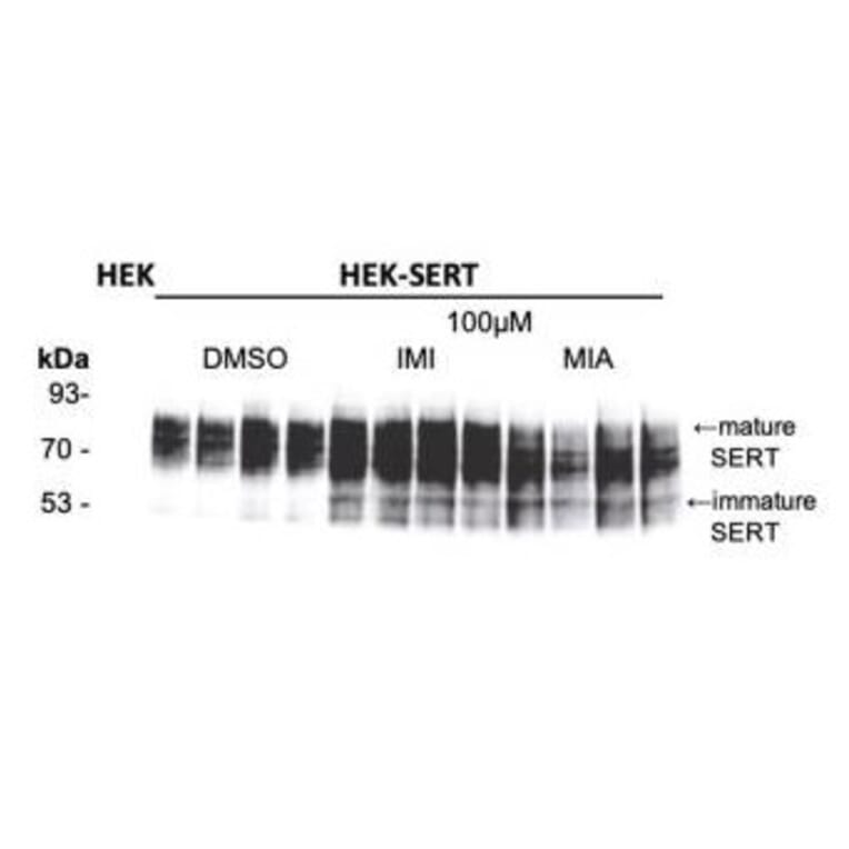 Western Blot - Anti-SERT Antibody - Antibodies.com