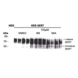 Western Blot - Anti-SERT Antibody - Antibodies.com