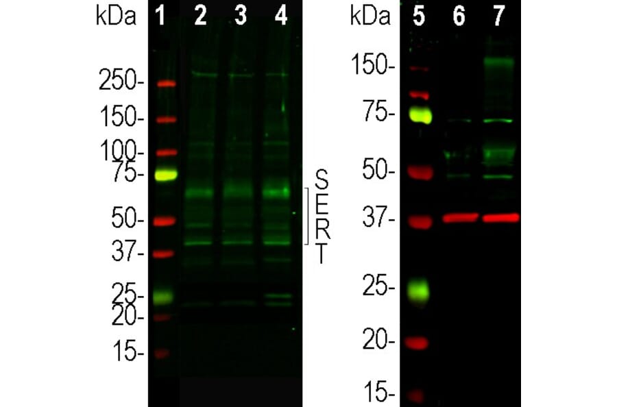 Western Blot - Anti-SERT Antibody (A104336) - Antibodies.com