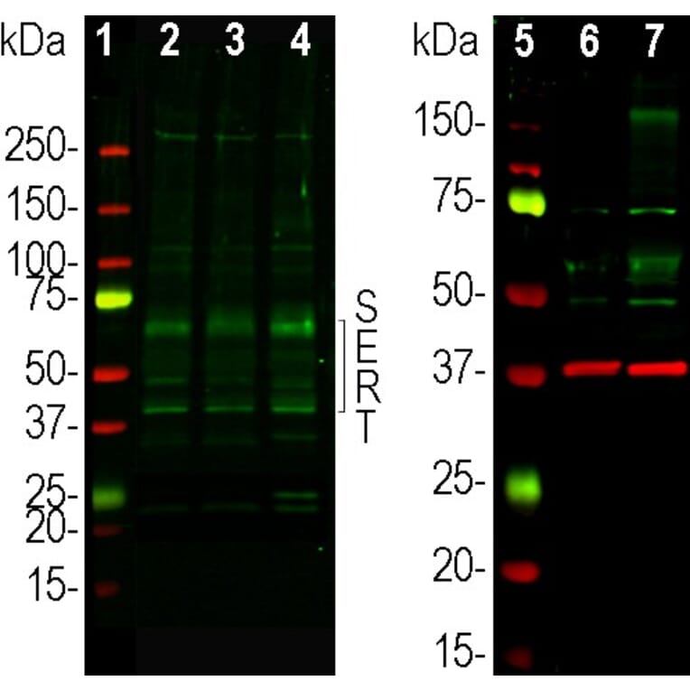 Western Blot - Anti-SERT Antibody - Antibodies.com (A104336)