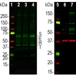 Western Blot - Anti-SERT Antibody - Antibodies.com (A104336)