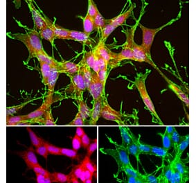 Immunofluorescence - Anti-DJ1 Antibody - Antibodies.com (A104338)