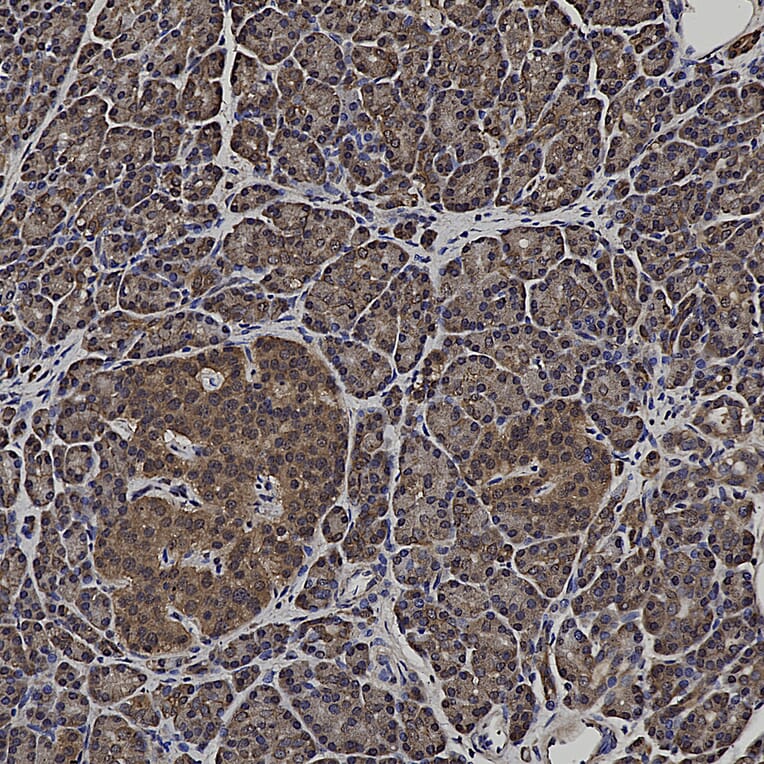 Immunohistochemistry - Anti-DJ1 Antibody (A104338) - Antibodies.com