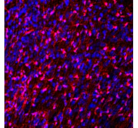 Immunofluorescence - Anti-FABP7 Antibody (A104339) - Antibodies.com